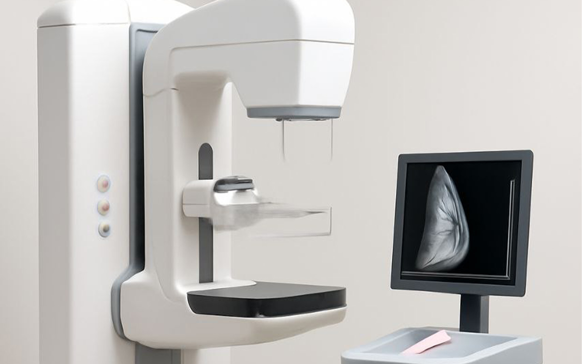 دستگاه کاست ماموگرافی دیجیتال چیست ؟